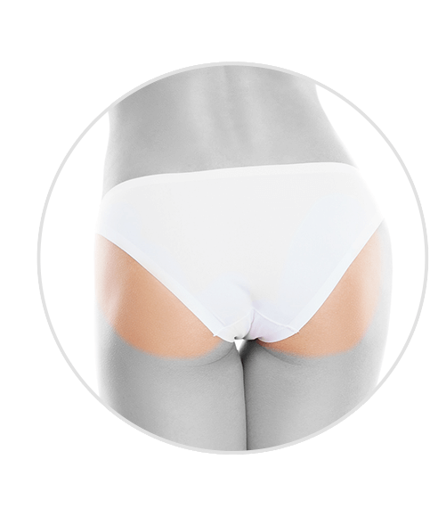 Buttocks hair removal